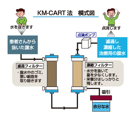 ＣＡＲＴ療法（Cell-free and Concentrated Ascites Reinfusion Therapy）とは？