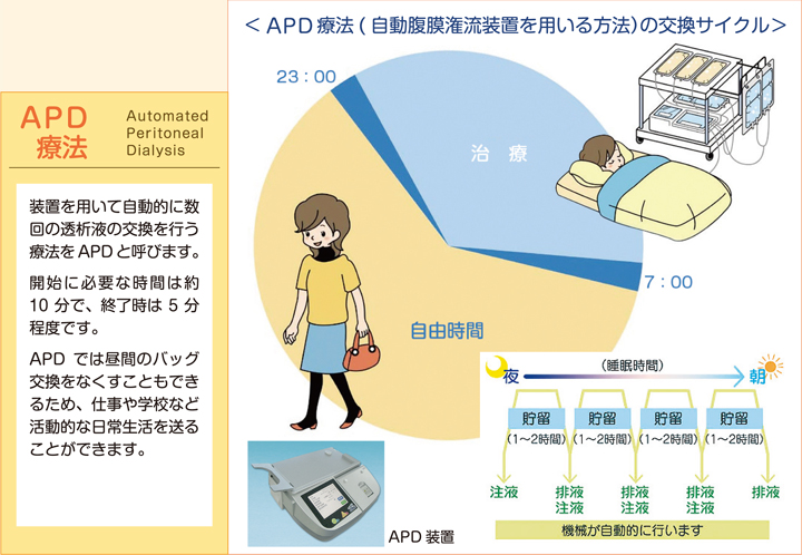 APD療法（自動腹膜潅流装置を用いる方法）の交換サイクル